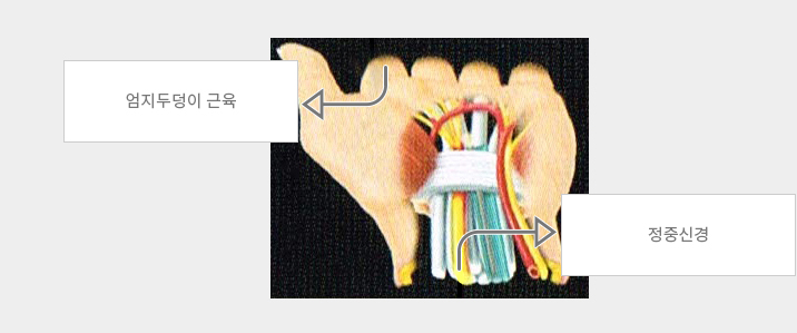 엄지두덩이 근육, 정중신경
