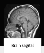 Brain sagital