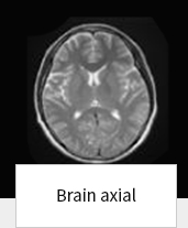 Brain axial