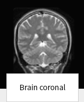 Brain coronal