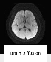 Brain Diffusion