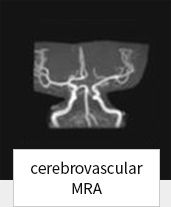 cerebrovascular MRA